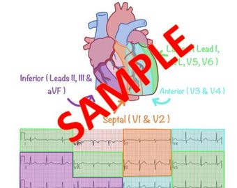 ECG Reference Cards DIGITAL