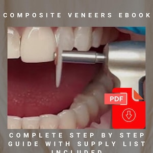Puede incluir: Un gráfico rojo y blanco con un icono de carrito de compras y un icono de nube con una flecha hacia abajo. El texto dice "Agregar al carrito para comprar. Siga las instrucciones proporcionadas para finalizar su compra. Descargue el libro electrónico sobre carillas después de completar su compra, por favor revise su correo electrónico para la confirmación de Etsy con respecto a su pedido. Dentro del correo electrónico, ubique y haga clic en el enlace de descarga para el libro electrónico sobre carillas una vez que haya hecho clic en él, descargue el archivo en su computadora."