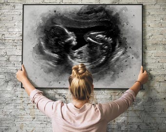 Baby Ultrasound Watercolor Portrait, Sonogram Wall Art, Baby Shower Gift, Gender Reveal Painting, Pregnancy Present, Newborn Baby Portrait