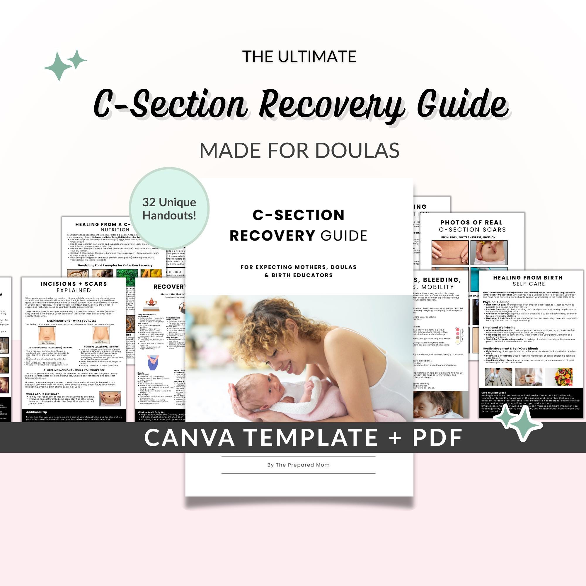 C Section Recovery Guide, Postpartum Doula Handouts + Prenatal Class ...