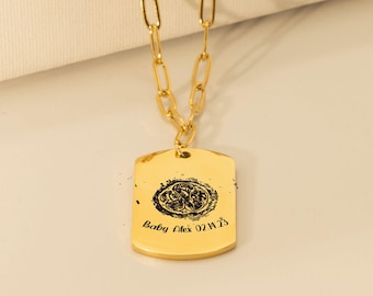 Personalized IVF Embryo Keepsake Necklace: in Vitro Fertilization