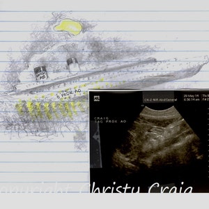 Titanic Proximal Aorta Print