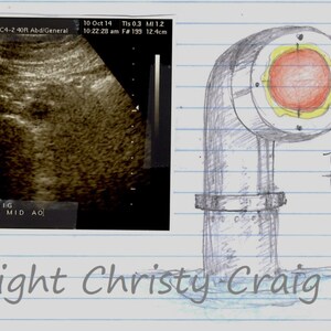 Puede incluir: Una ilustración dibujada a mano de un periscopio con una lente roja y amarilla. El periscopio está parcialmente sumergido en el agua. El texto "1°74'AP/ 1°72'RL" está escrito debajo del periscopio. El texto "copyright Christy Craig" está escrito debajo del agua.