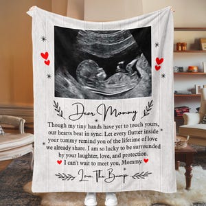 Personalized Ultrasound Photo Blanket, Expecting Mom Fleece Blanket