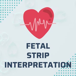 Labor and Delivery Fetal Heart Rate Interpretation Notes, OB Nursing Student Notes, New Grad L and D, Fetal Monitoring Note Instant Download