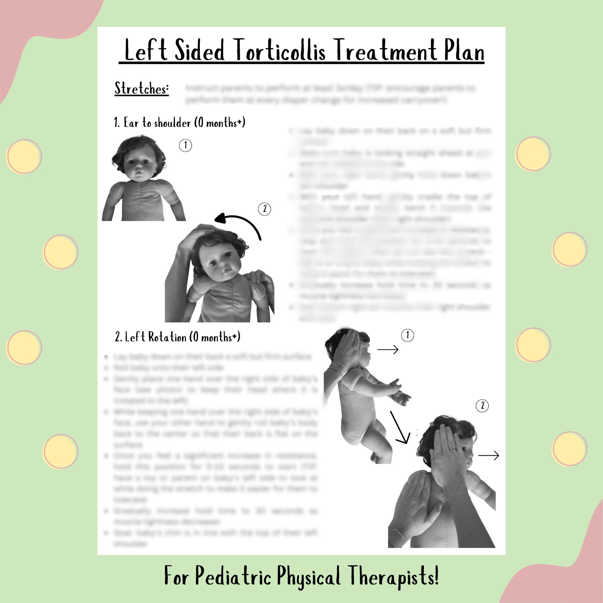 Congenital Torticollis Plagiocephaly Physical Therapy Severe