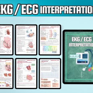 EKG ECG Interpretation Guide | Cardiac Nursing Study Notes (PDF) - Etsy