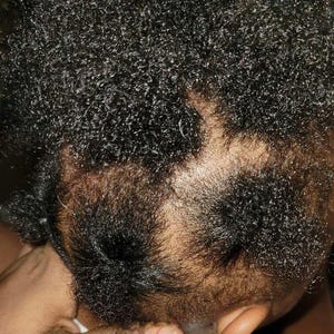 Scalp Juice Hair Growth Oil 2oz