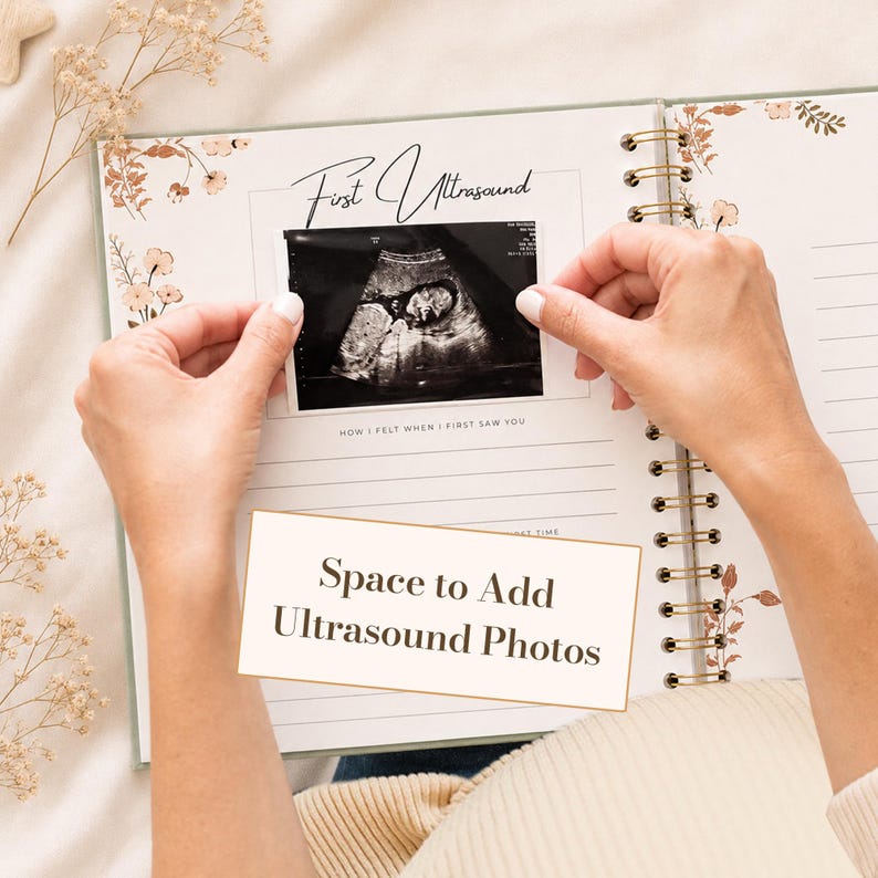 May include: A spiral-bound memory book with floral illustrations featuring a page titled First Ultrasound. The page includes a black and white ultrasound scan, lined sections for notes, and a rectangular overlay with the text Space to Add Ultrasound Photos.