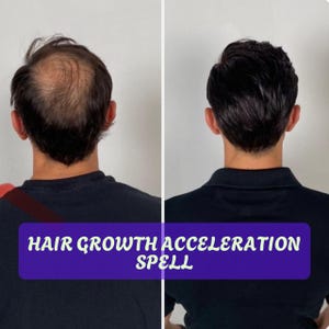 Hair Growth Acceleration Spell – Stimulate Rapid Hair Growth, Strength, and Beauty – Powerful Ritual for Thick, Healthy, and Fast-Growing