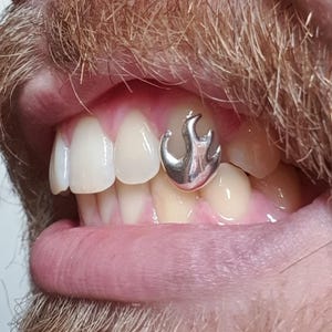 FLAME custom grillz dental caps worldwide delivery