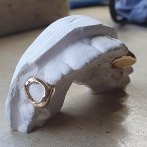 WINDOW custom grillz dental caps worldwide delivery