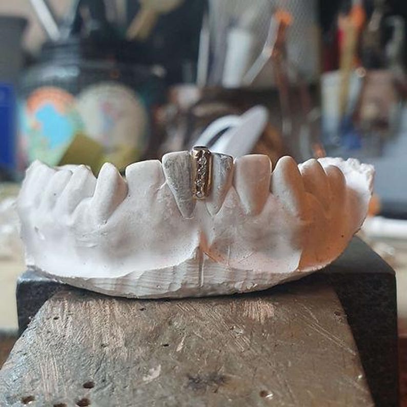 Puede incluir: Primer plano de un molde dental con una rejilla de dientes de oro. La rejilla es una barra &uacute;nica con peque&ntilde;os diamantes engastados.