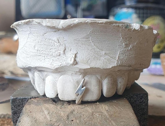 GAP FILLER Grillz custom made worldwide delivery