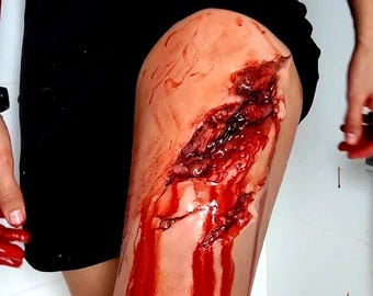 May include: A leg with a deep, open wound, appearing to be a severe laceration. Blood is visible, streaming down the leg. The image is graphic and may be disturbing.