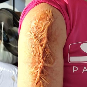 Può includere: Una protesi di ferita dettagliata applicata a un braccio. La protesi color carne presenta un design profondo e strutturato con una spirale centrale e motivi lineari, creando un effetto di lesione realistico. Il braccio è parzialmente visibile, con una camicia rosa sullo sfondo.