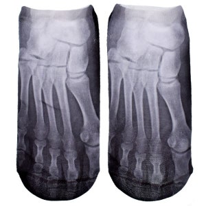May include: A pair of black ankle socks with a graphic print of an x-ray image of a foot.