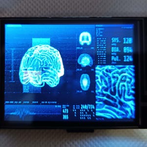 May include: A blue and white screen displaying a 3D rendering of a brain with the text "SYS. 120 DIA. 894 Pul. 124".