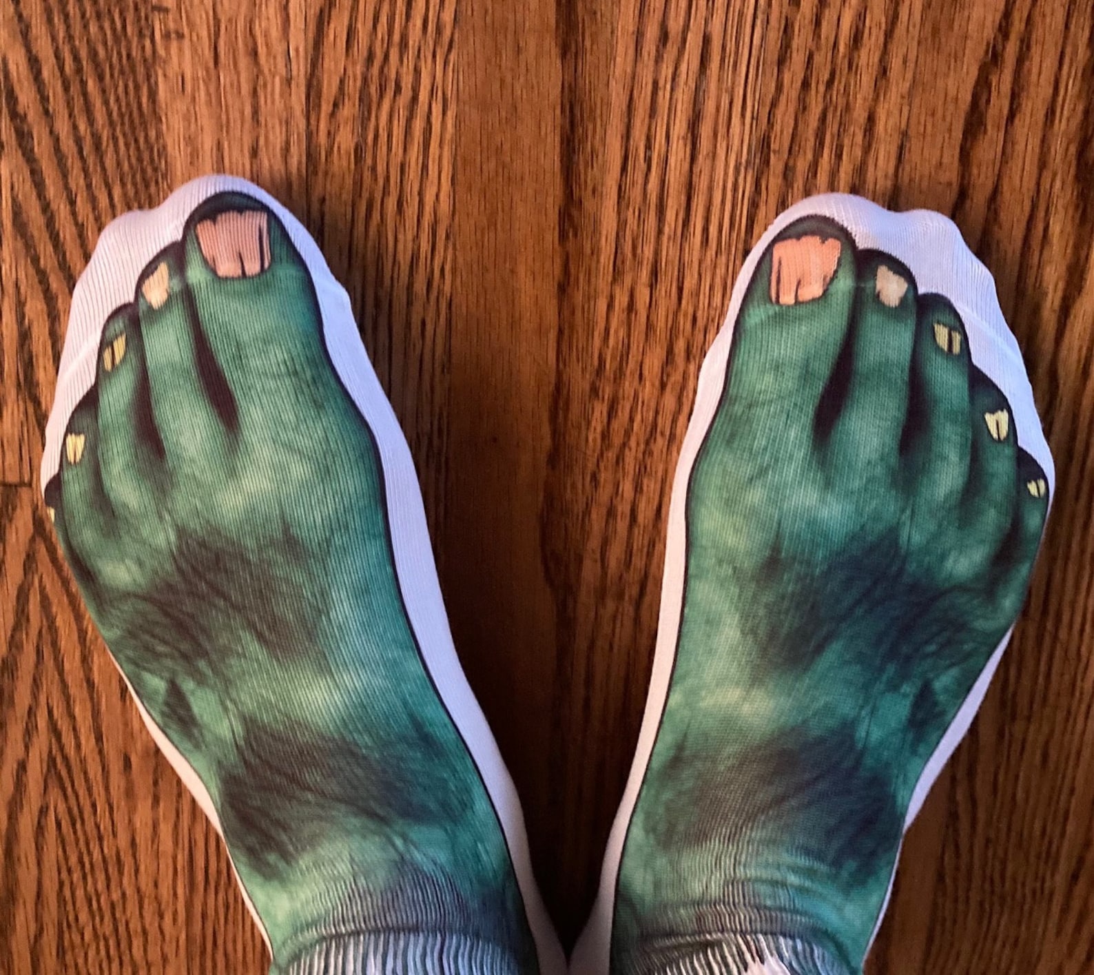 Albums 92+ Pictures Can You Sell Ugly Feet Pictures Latest