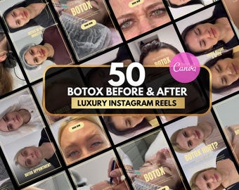 50 botox instagram reels, botox and filler reels, botox canva template, nurse injector reel Medspa Reel Templates, botox before and after