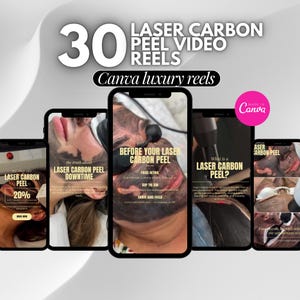 May include: A digital collection of 30 Laser Carbon Peel video reels for Canva, featuring smartphone mockups displaying skincare treatment information, instructional text, and promotional offers for laser carbon peel facial procedures.