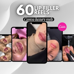 60 Lippen Füller Rollen Instagram, Lippen Füller Rollen vorher und nachher