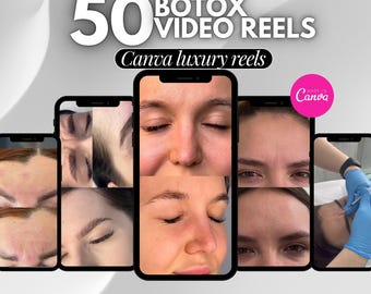 50 botox instagram reels, botox and filler reels, botox canva template, botox video, Medspa Reel Templates, botox before and after