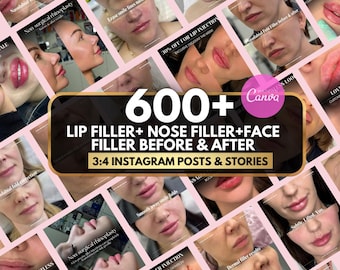 Face filler bundle, Lip filler, Chin filler , Nose Filler instagram post | Face filler injection before and after, Botox canva, medspa post