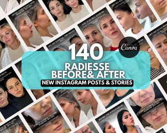 Radiesse Before & After Photo Instagram Template | Nurse injector Canva template, botox and filler posts, filler before and after canva
