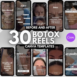 30 Botox Instagram video Reels | Skincare video | Botox canva template reels, Medspa video reels, nurse injector reels instagram