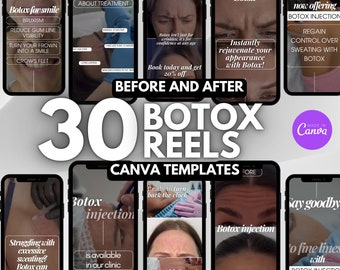 30 Botox Instagram video Reels | Skincare video | Botox canva template reels, Medspa video reels, nurse injector reels instagram