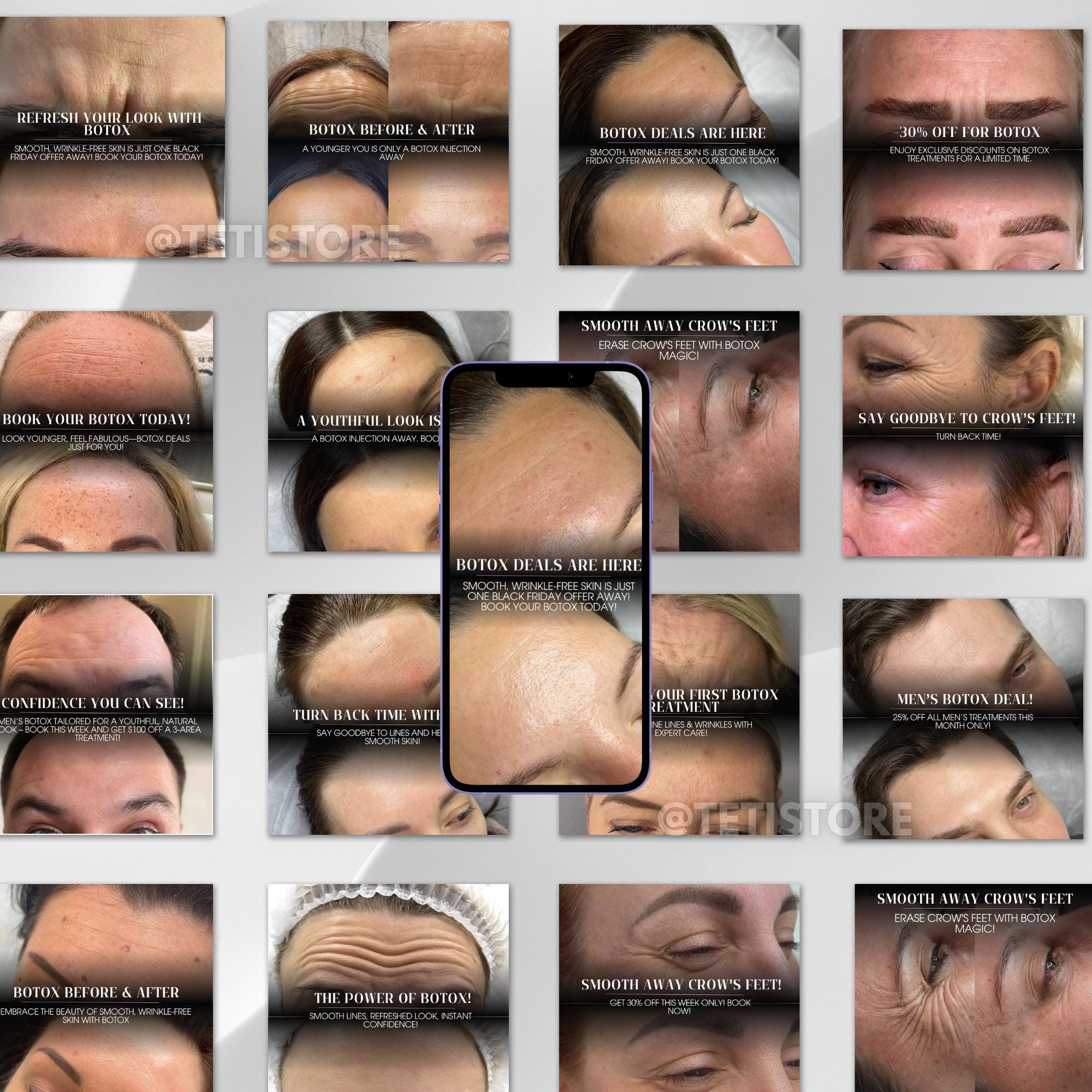30 Botox Instagram Posts | Botox Before and After | Skincare | Botox ...