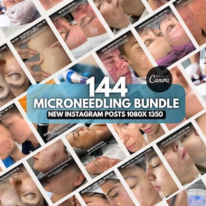 Microneedling Instagram posts | Microneedling before and after | Skincare | Microneedling canva template, Microneedling Reels
