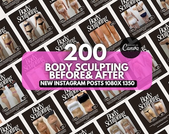 Body Sculpting Canva Templates | Before & After Posts | Body Contouring instagram template | RF Cavitation | HIFU | Ultrasonic Cavitation