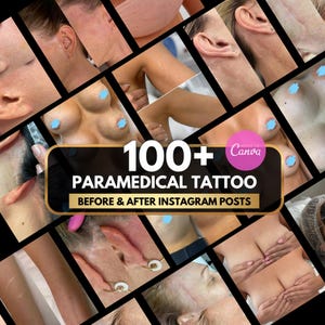 Puede incluir: Un collage de imágenes de antes y después que muestran procedimientos de tatuaje paramédico en la piel, incluyendo cicatrices y areolas. El texto central dice 100+ PARAMEDICAL TATTOO BEFORE & AFTER INSTAGRAM POSTS con un logo rosa de Canva.