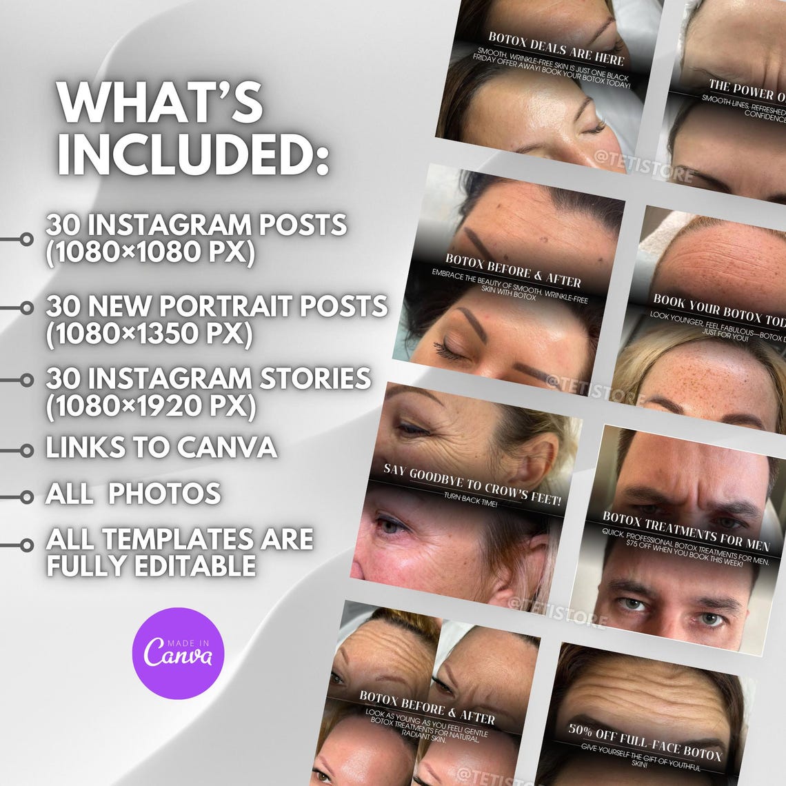 30 Botox Instagram Posts | Botox Before and After | Skincare | Botox ...