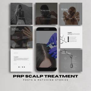 May include: A collection of social media posts and stories about PRP scalp treatment. The images include a person's hair being injected, infographics, and a person with long hair. The text includes "PRP Scalp Treatment" and "Posts & Matching Stories."