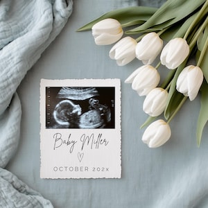 Baby Boy Schwangerschaft Ankündigung Digital Gender Reveal Blau Minimalist Einfache Tulpen Bearbeitbare Vorlage Ultraschall Social Media Es ist ein Junge