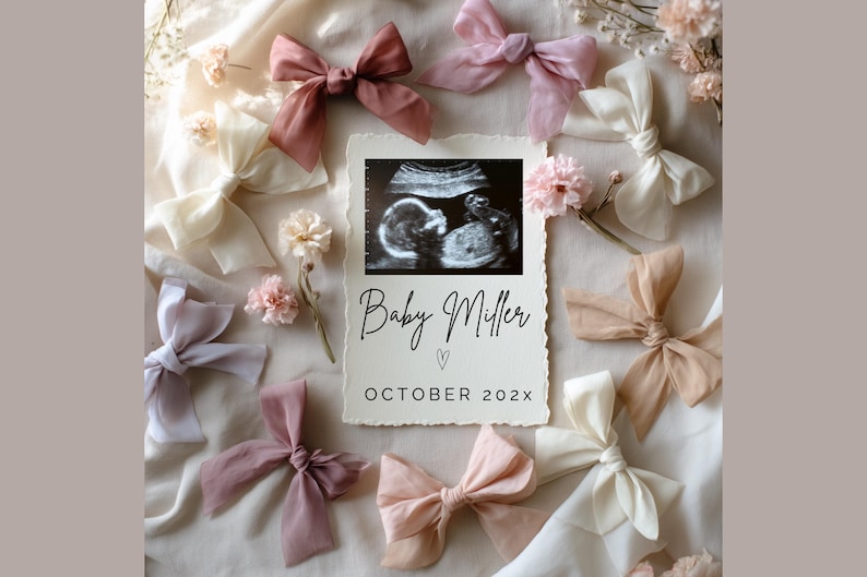 May include: A white card with the text "Baby Miller" and "October 202X" surrounded by pink and white bows and flowers. A black and white ultrasound image is in the center of the card.