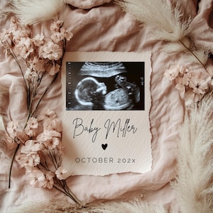 May include: A black and white ultrasound image of a baby in a white frame with the text "Baby Miller" and "OCTOBER 202X" on a pink fabric background with dried flowers.