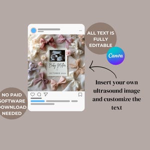 May include: A digital template for a social media post announcing a pregnancy. The template features a pink and white color scheme with a photo of an ultrasound image and the text "Baby Miller, October 2022".
