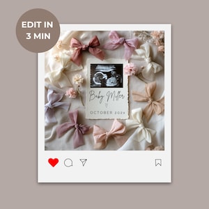 May include: A white framed Instagram post with a pink and white background. The post features a sonogram image with the text "Baby Miller" and "October 202X". The image is surrounded by pink and white bows and flowers.