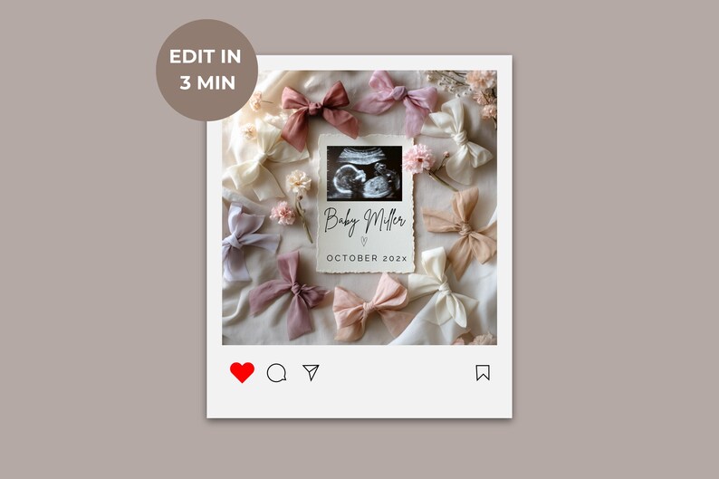 May include: A white framed Instagram post with a pink and white background. The post features a sonogram image with the text "Baby Miller" and "October 202X". The image is surrounded by pink and white bows and flowers.