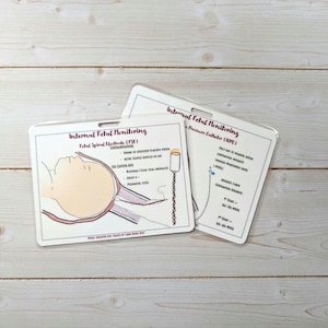 EFM-Internal Monitoring Badge Card- Visual Patient Education- Fetal Spiral Electrode-Intrauterine Pressure Catheter- Labor Nurse- CNM- MD