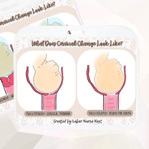 May include: A diagram illustrating cervical changes during labor. The image shows two stages: "Fully Effaced - Cervical Thinning" and "Fully Dilated - Ready for Birth." The text "What Does Cervical Change Look Like?" is at the top, with "Created by Labor Nurse Nest" at the bottom.