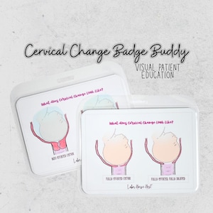 Cervical Change Badge Buddy | Visual Reference of Progression During Labor |  Nurse, Midwife, OB, Doula Badge Card