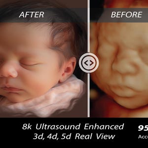 Ultrasound to Baby Portrait | Custom AI Baby Face Art | Pregnancy Keepsake Gift | Baby Shower Gift | Realistic 3D 4D Scan to Photo