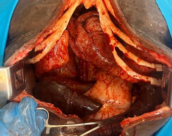 Full Set of Human Organs (Prop)