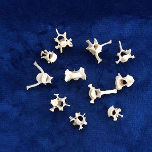 May include: A collection of 11 white vertebrae bones on a blue background. The bones are arranged in a circle.