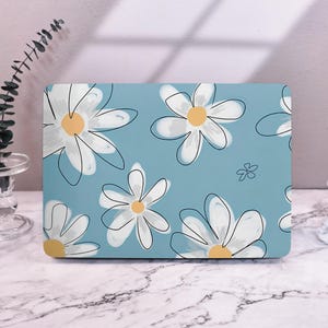 Fashion Lady Floral Laptop Case Skin MacBook Case for Air 15 13 11 Macbook Case, Pro 16 15 14 13, 2022 2021 2020 M1 M2 Air 13 Macbook Cover